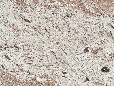 Immunohistochemistry: LRP-1 Antibody [NBP2-62753]